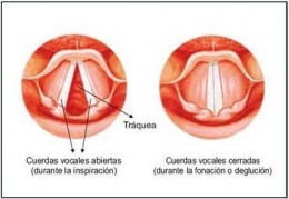 Cuerdas vocales